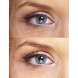 Le'Vea Youth Treatment: Eye Wrinkle Treatment + Night